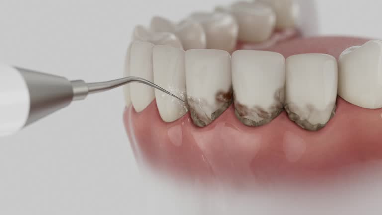Reliable Dental Implants contractor in Calhoun County County, GA by Dentist Open Now
